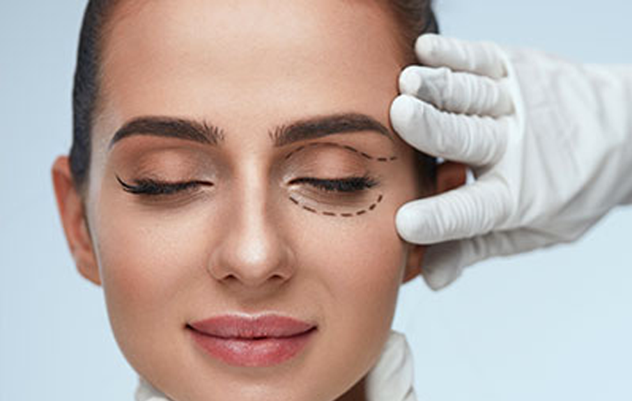 Oculoplastic Surgeries