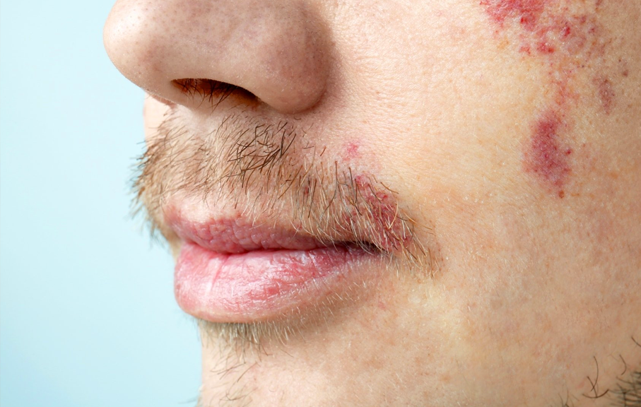 Birth Marks & Defects